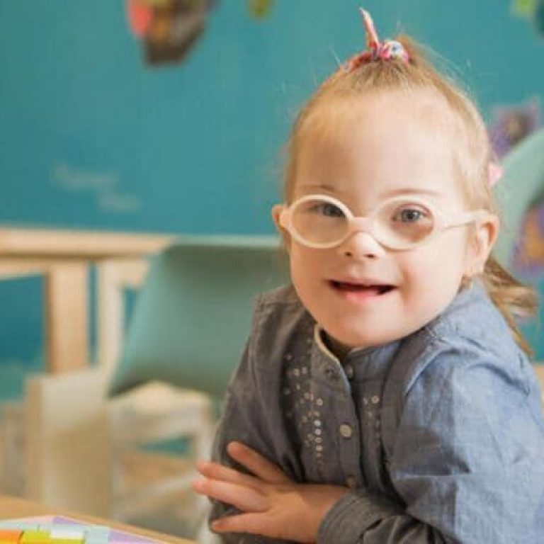 Sindrome-de-Down-_-condicoes-e-alteracoes-oftalmologicas-pnqtjd1rqt30gyxnyqxuxqi39h07e292fn32gbq3ow-1-pnvx11m8qbrjfvt9f39untcixmfr6scpyqf2edewc0