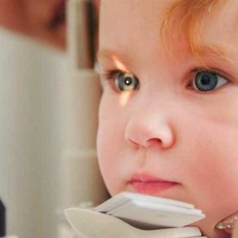 Teste-do-olhinho-entenda-sua-importância-ananindeua-oqe1m31se7dkznxerye4m7trhoqlcu65qns6kusw8g